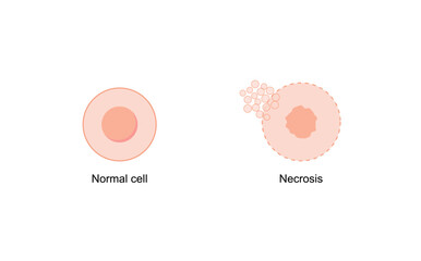 Necrosis, Pathologic Cell Death, vs normal cell. Vector illustration