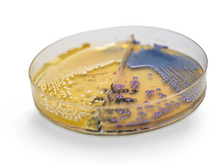 Medical themes: Petri dish showing Candida parapsilosis