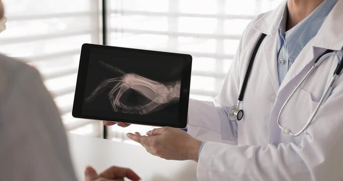 Woman radiologist explains type of patient arm injury, fracture or dislocation displayed on xray scan seen on digital tablet screen during professional medical imaging consultation, close up crop view