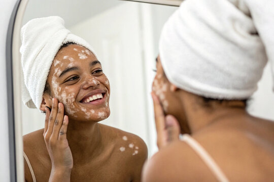 Smiling woman with vitiligo applies skin cream in mirror. Depicts self-care with skin diversity; for beauty campaigns, health awareness, and positive representation. - Powered by Adobe