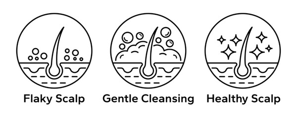 Anti dandruff icon set. Strong healthy hair line icons. Anti dandruff logo, label, badge, symbol, sign, circle, line, vector, isolated illustration. Anti dandruff label for product packaging design.