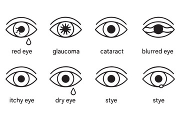 eye health medical icons showing conditions such as red eye, glaucoma, cataract, dry eye, blurry vision, stye, and itchy eye, glaucoma and eye care illustration