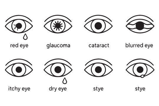 eye health medical icons showing conditions such as red eye, glaucoma, cataract, dry eye, blurry vision, stye, and itchy eye, glaucoma and eye care illustration