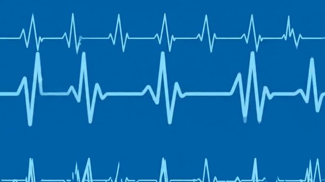 A blue background displays multiple heart rate monitor lines, illustrating medical concepts of health, rhythm, and vital signs.