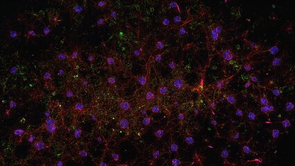 Confocal laser scanning microscopy imaging of CA1 area cells in the mouse hippocampus highlighted by immunofluorescence