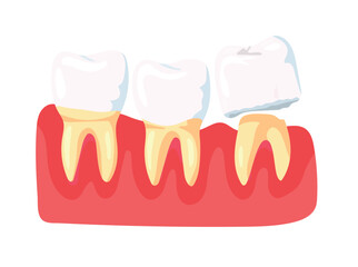 Model of human jaws with teeth. Problem with teeth. Flat vector clipart, illustration with isolated background.