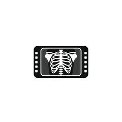 X-ray image of ribs displayed on a screen, medical diagnostics.