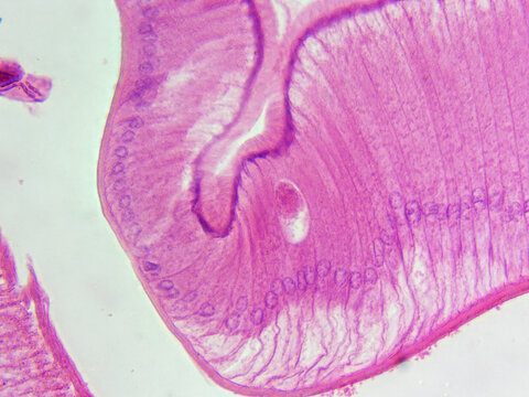 Histology Microscope Image of Female Ascaris Roundworm Intestines Cross Section (400x)