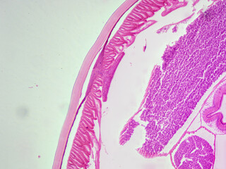 Histology Microscope Image of Male Ascaris Roundworm Lateral Line Cross Section (40x)
