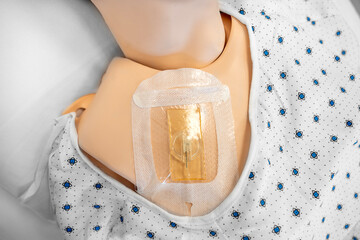 Close up of a medical manikin with a central venous catheter insertion site covered by transparent dressing, used for hospital training, nursing education, and patient care simulation