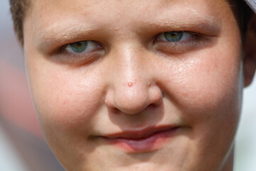 Fototapeta premium A young boy with a green eye stares at the camera