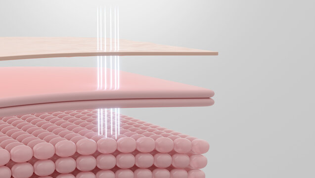 HIFU laser targeting SMAS layer for skin tightening and facelift 3D