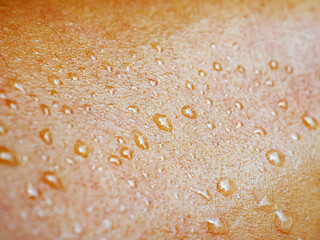 Skin, macro of water drops and texture or body of a person, armhair human and sweat with droplets