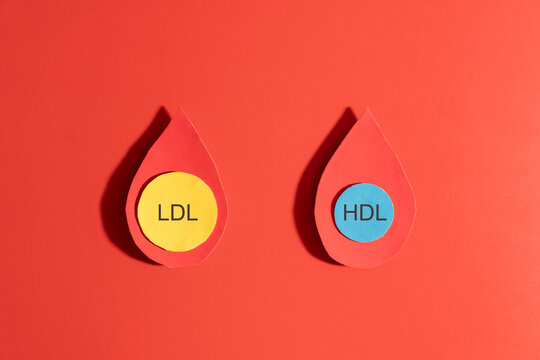 High cholesterol concept. LDL cholesterol with yellow spherical particles and HDL cholesterol with blue spherical particles inside blood droplets on red background. Cardiovascular disease problem. - Powered by Adobe
