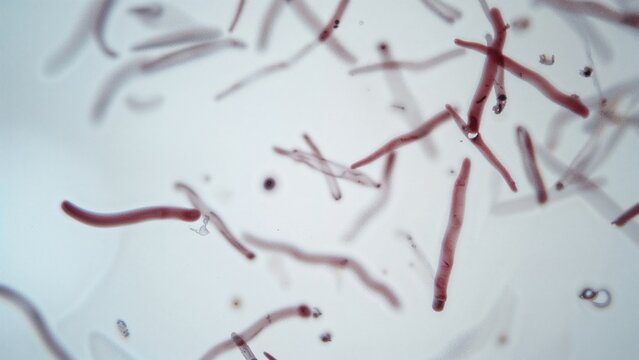 Blood smear of a dog showing unsheathed microfilariae under light microscopy of heartworms