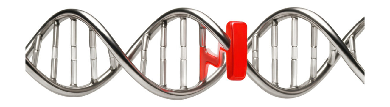 Frameshift mutation due to insertion of an extra cytosine base in a DNA strand