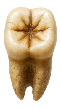 Denisovan tooth with distinct cusp pattern and worn occlusal surface