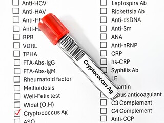 Blood sample tube and paper order request for cryptococcus Ag test analysis.