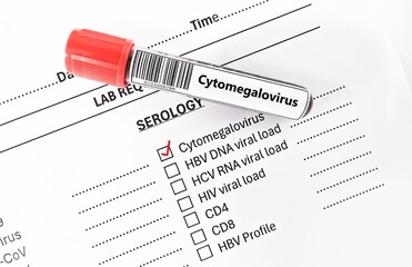 Blood sample tube and paper order request for cytomegalovirus test analysis.