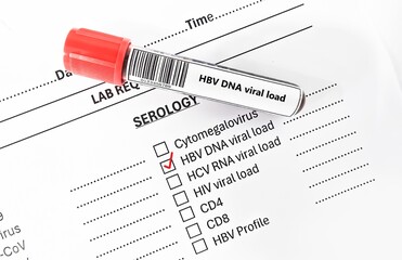 Blood sample tube and paper order request for variola virus test analysis.