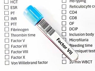 Blood sample tube and paper order request for factor VII  test analysis.