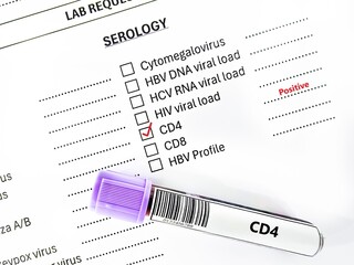 Obraz premium Blood sample tube positive result for CD4 test analysis.