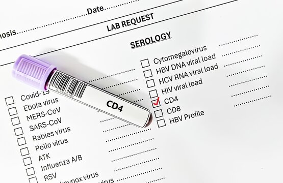Blood sample tube and paper order request for CD4 test analysis.