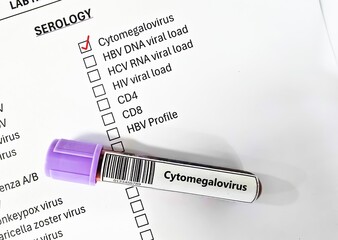 Blood sample tube and paper order request for cytomegalovirus test analysis.