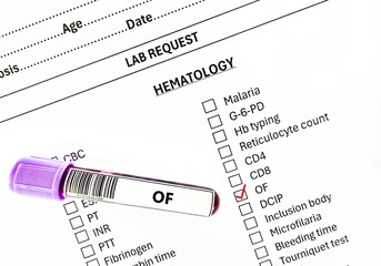 Blood sample tube and paper order request for osmotic fragility test analysis.