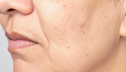 Detailed close-up of an older person's face, highlighting wrinkles and skin texture