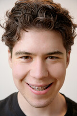 Obraz premium Young man smiling and showing braces on teeth: orthodontic treatment