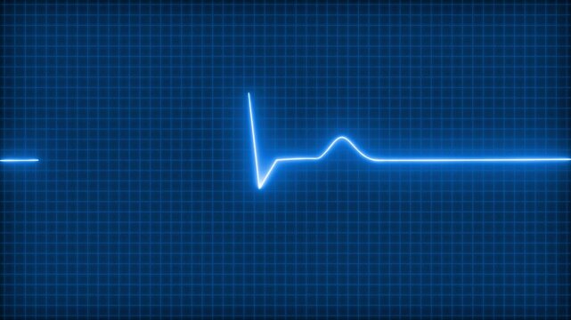 Digital ECG Display with Flatline and Spike, Neon Glowing Heartbeat Pulse Wave Signal Animation