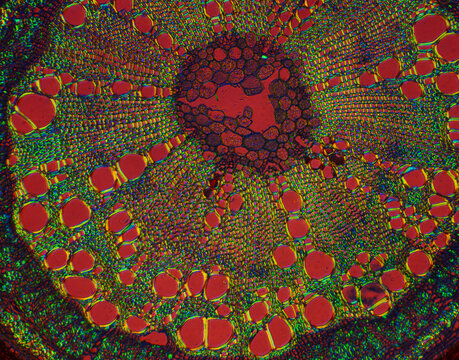 micrograph of Herba Abrus plant cells