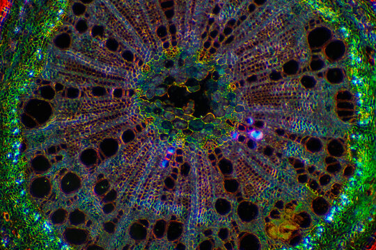 micrograph of Herba Abrus plant cells