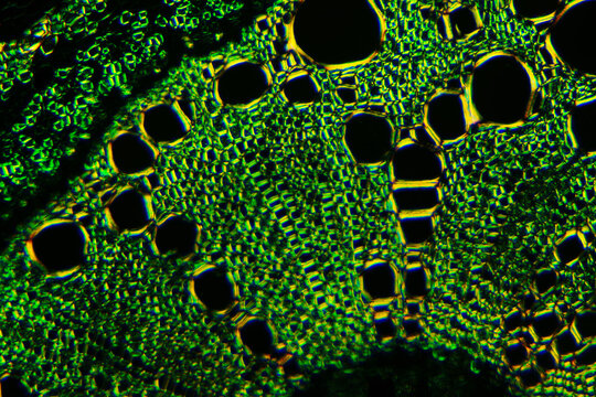 micrograph of Herba Abrus plant cells