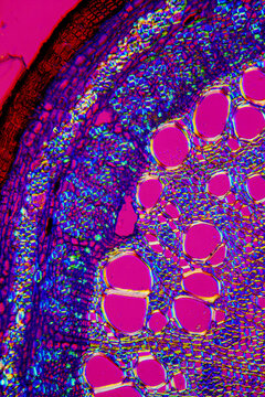 micrograph of Herba Abrus plant cells