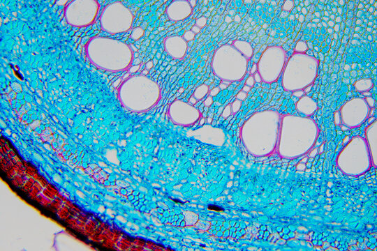 micrograph of Herba Abrus plant cells