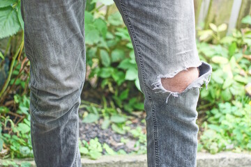 a mans leg in gray torn old jeans with a hole on a summer street
