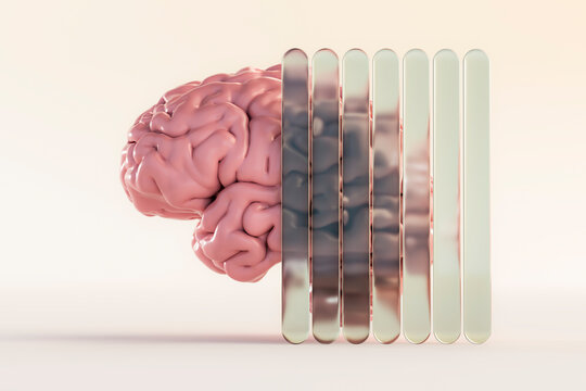 Artificial intelligence