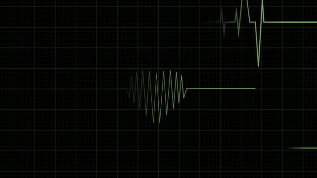 Cardiograph Recording. Motion Graphic for Use in Presentations, Education Manuals, Design, Etc.