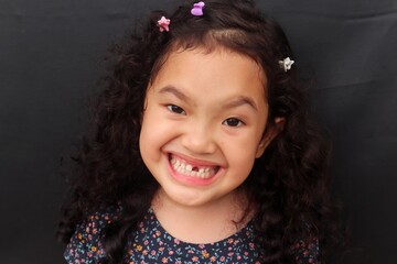 Asian girl with curly hair smiles adorable while showing her missing upper teeth, close-up view and dark background.