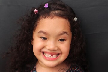 Asian girl with curly hair smiles adorable while showing her missing upper teeth, close-up view and dark background.