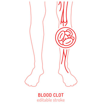 Blood clot in leg vein vector icon, medical pictogram for vascular disease awareness
