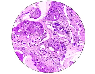 Microscopic view of purple-hued tissue sample, circular format