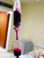 Closeup of Blood transfusion, the process of transferring blood products into a person's circulation intravenously, Transfusions are used for various medical conditions to replace lost blood