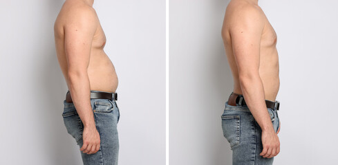 Before and after collage showing man with good and bad posture against white background, closeup