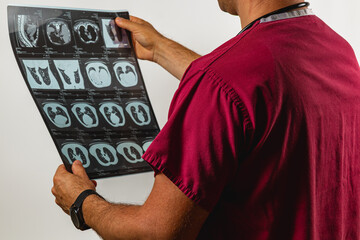 Medical professional examines X-ray images in a clinical setting