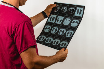 Doctor examining medical X-rays in a clinical setting at a hospital