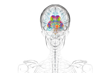 A brain tumor causing hydrocephalus, 3D illustration