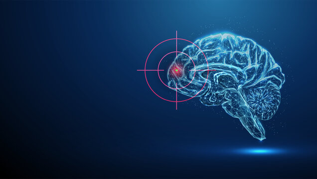 Abstract blue brains with target on frontal lobe. Brain disorders, medical treatment, targeted therapy, medical treatment, neuroscience concept.